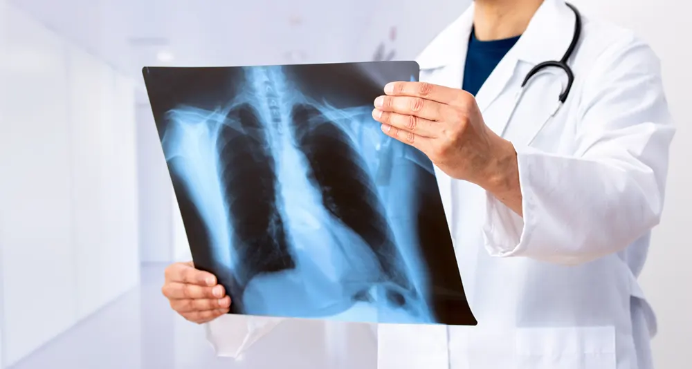 Dr. med. Abdel Hakim Bayarassou - Pneumologie Marienburg